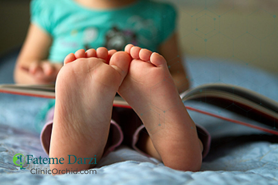 عوارض صافی کف پا در کودکان